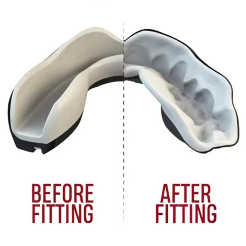 Protège-Dents Boxe MMA - Protection Sport Combat Junior